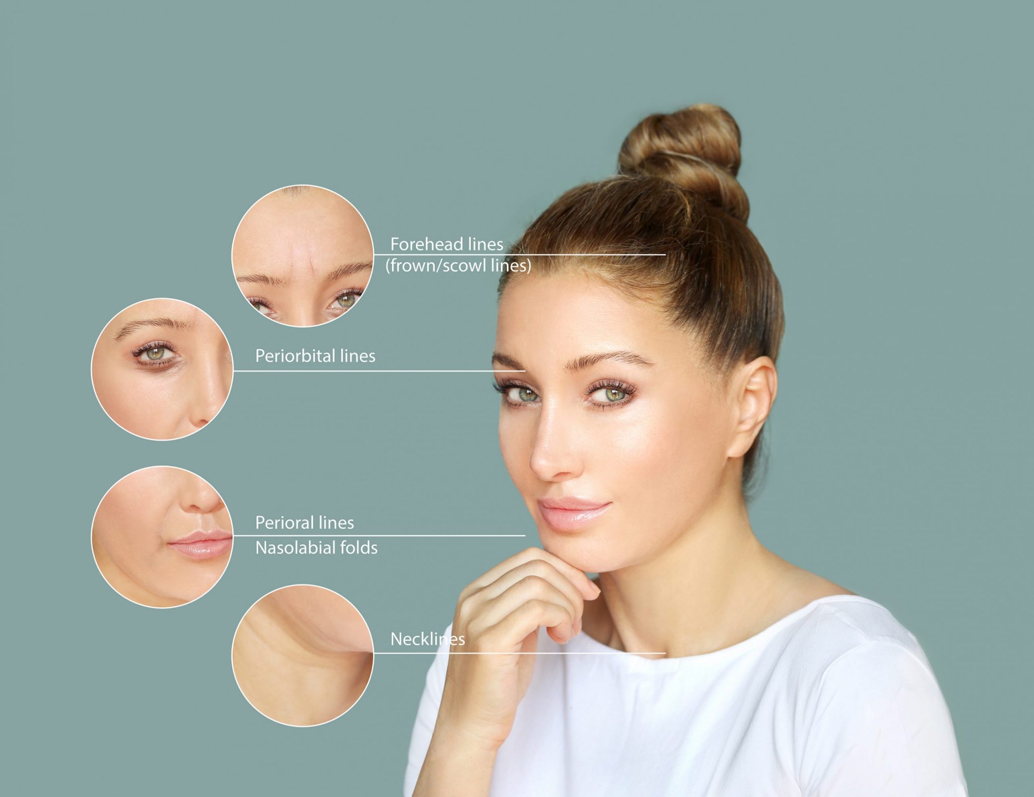 Botox - How to Choose