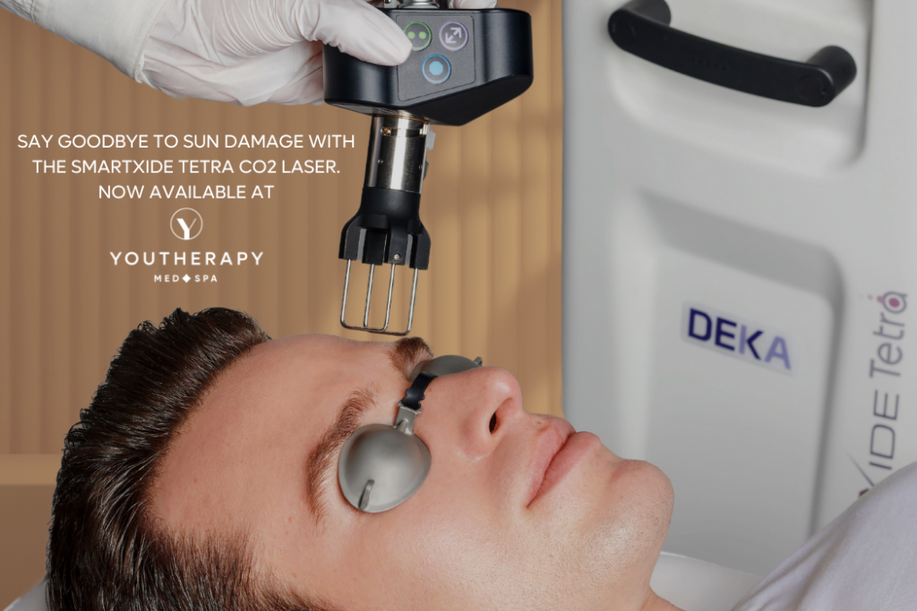 DEKA SmartXide Tetra CO2 Laser